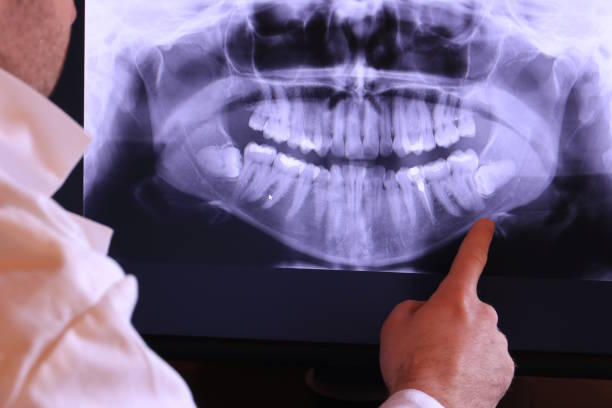 Best Walk-In Emergency Dental Services in Vineyard, CA